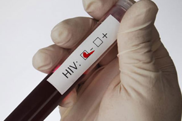 РязГМУ присоединится к Всероссийской неделе тестирования на ВИЧ-инфекцию