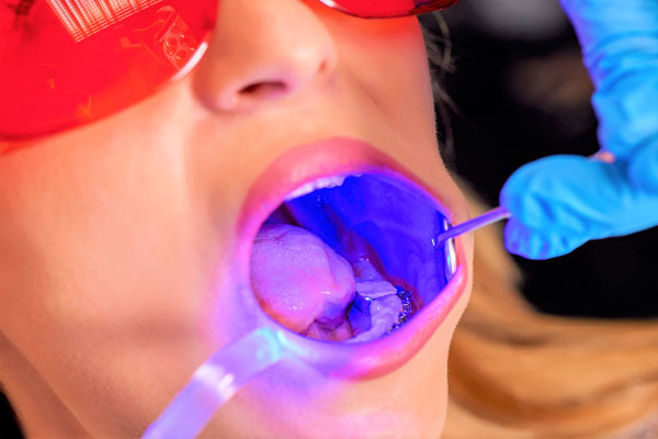 СТОМАТОЛОГИЧЕСКАЯ ПОЛИКЛИНИКА РЯЗГМУ ПРИГЛАШАЕТ РЯЗАНЦЕВ НА БЕСПЛАТНЫЙ ОНКОСКРИНИНГ