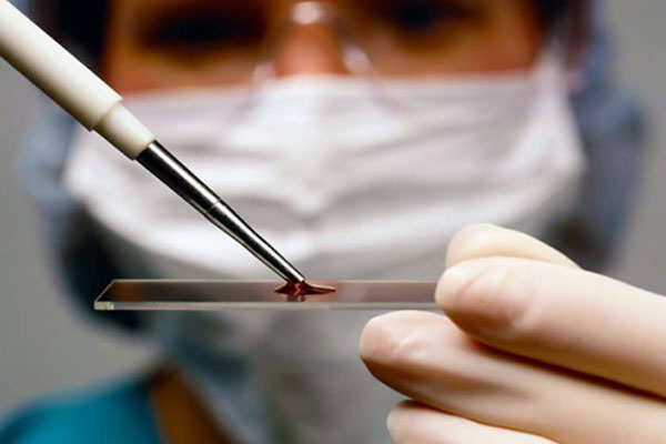 Научно-клинический центр иммунологии и гематологии предлагает бесплатно проверить гемоглобин 