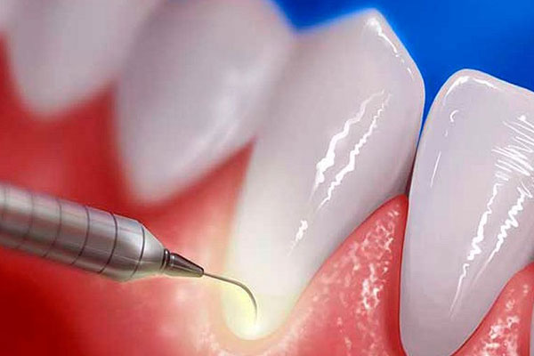 ПРОБЛЕМЫ ПАЦИЕНТОВ С ЗАБОЛЕВАНИЯМИ ПАРОДОНТА ОБСУДЯТ В РЯЗГМУ