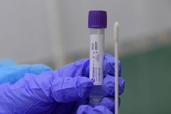 ЛАБОРАТОРИЯ НАУЧНО-КЛИНИЧЕСКОГО ЦЕНТРА УНИВЕРСИТЕТА НАЧИНАЕТ ТЕСТИРОВАНИЕ НА КОРОНАВИРУС SARS COV-2