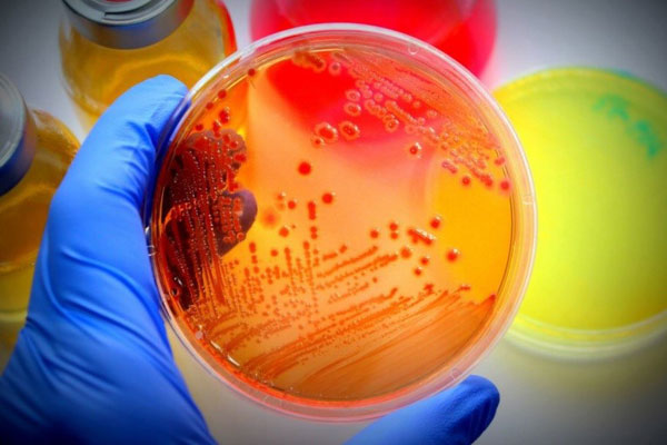 КАФЕДРА МИКРОБИОЛОГИИ ОБЪЯВЛЯЕТ О ПРОВЕДЕНИИ ВНУТРИВУЗОВСКОЙ ОЛИМПИАДЫ ПО МИКРОБИОЛОГИИ  ДЛЯ СТУДЕНТОВ ЛЕЧЕБНОГО ФАКУЛЬТЕТА
