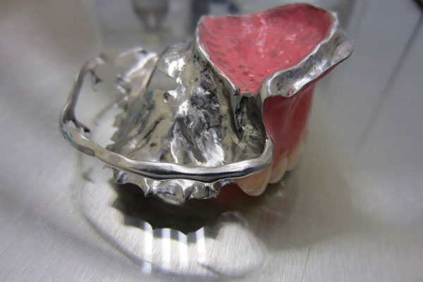 Медики РязГМУ разработали челюстной протез нового поколения для реабилитации пациентов 