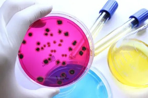 ВНУТРИВУЗОВСКАЯ ОЛИМПИАДА ПО МИКРОБИОЛОГИИ ДЛЯ СТУДЕНТОВ 3 КУРСА МЕДИКО-ПРОФИЛАКТИЧЕСКОГО ФАКУЛЬТЕТА